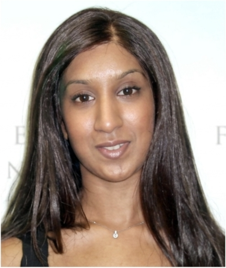 After hair replacement - female client