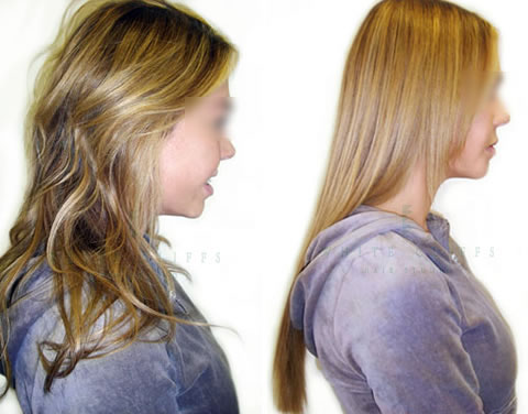 Hair extensions before and after