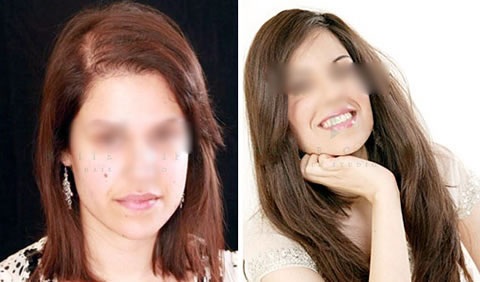 Hair volumizer before and after - Client 1