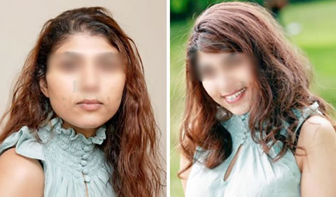 Hair volumizer before and after - Client 2