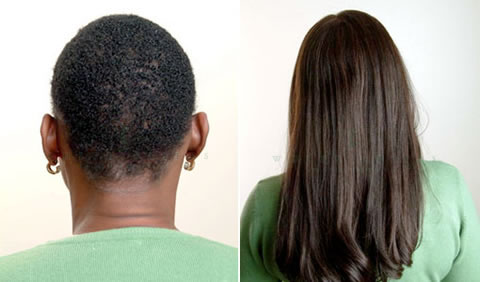 Women's hair replacement before and after