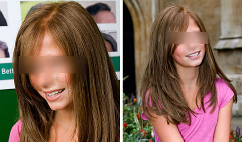 Women's hair replacement before and after
